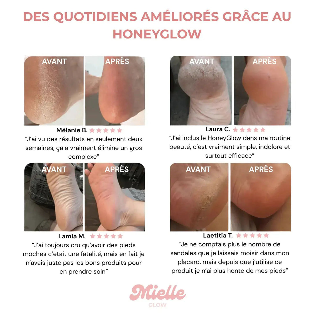 ✨ HoneyGlow™ – Kit Beauté Pieds